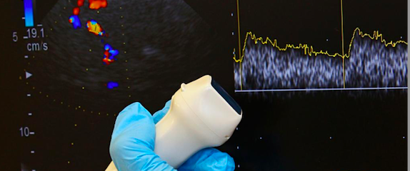 Curso teórico/práctico de Doppler Transcraneal y ecografía cerebral